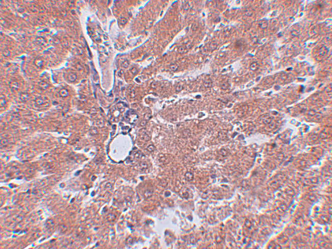 JMJD5 Antibody in Immunohistochemistry (IHC)