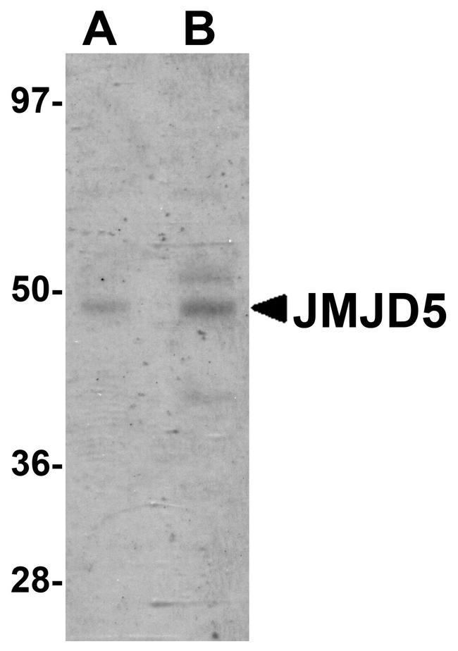 JMJD5 Antibody in Western Blot (WB)