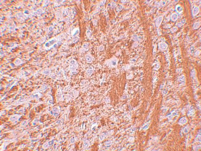 JMJD6 Antibody in Immunohistochemistry (IHC)