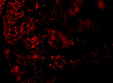 AGTR1 Antibody in Immunocytochemistry (ICC/IF)