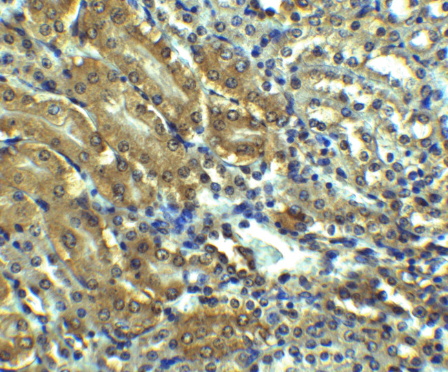 AGTR1 Antibody in Immunohistochemistry (IHC)