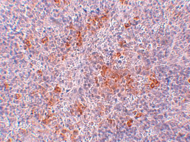 AGTR1 Antibody in Immunohistochemistry (IHC)