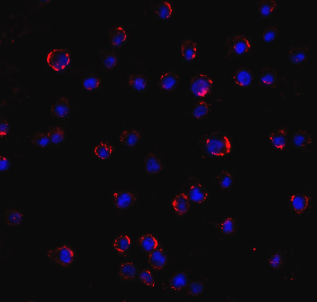 AGTR2 Antibody in Immunocytochemistry (ICC/IF)