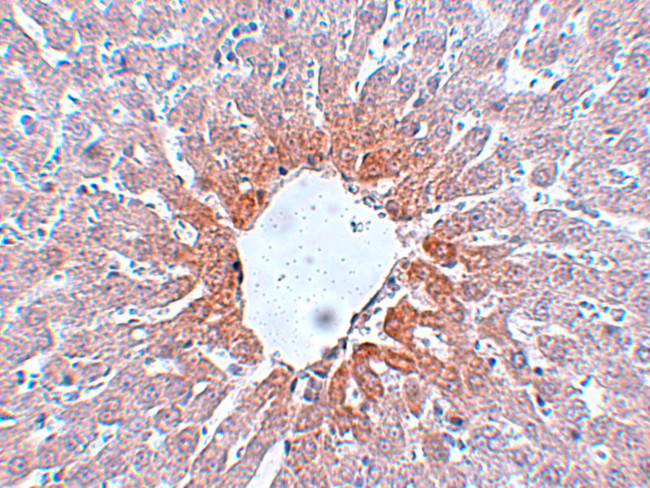 AGTR2 Antibody in Immunohistochemistry (IHC)