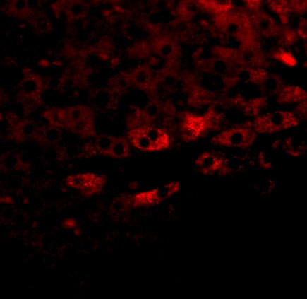 Prosapip2 Antibody in Immunohistochemistry (IHC)