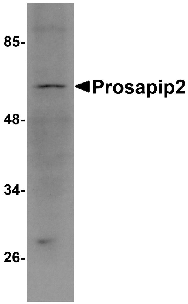 Prosapip2 Antibody in Western Blot (WB)