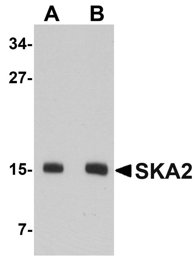 SKA2 Antibody in Western Blot (WB)