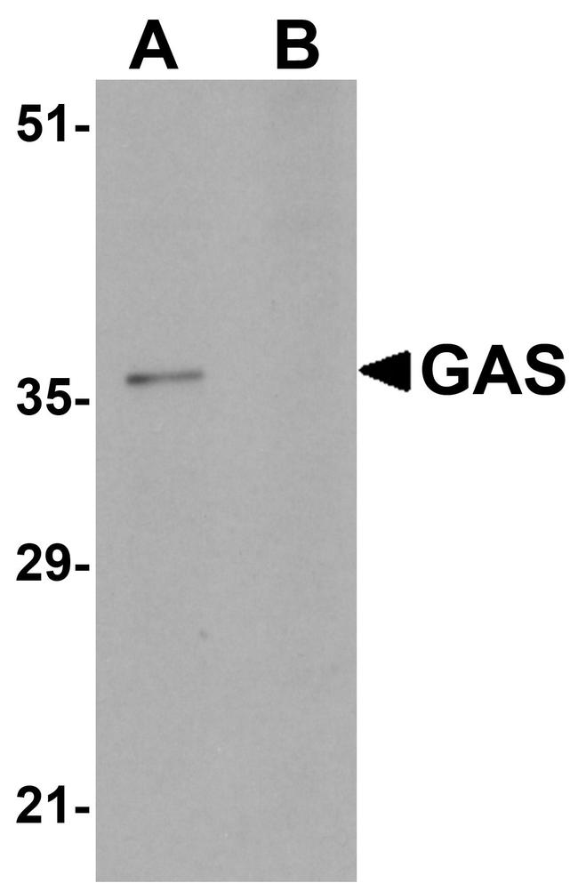 PAGR1 Antibody in Western Blot (WB)