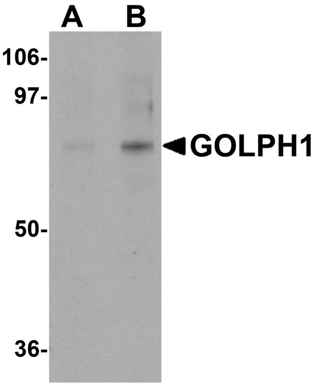 ACBD3 Antibody in Western Blot (WB)