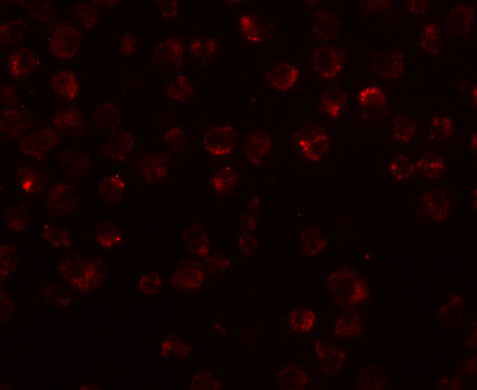 NDUFAF2 Antibody in Immunocytochemistry (ICC/IF)