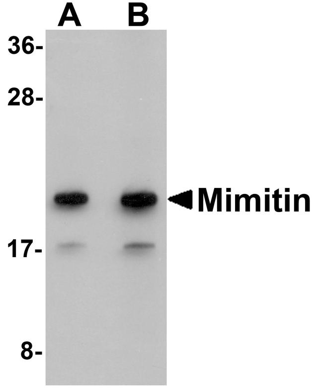 NDUFAF2 Antibody in Western Blot (WB)