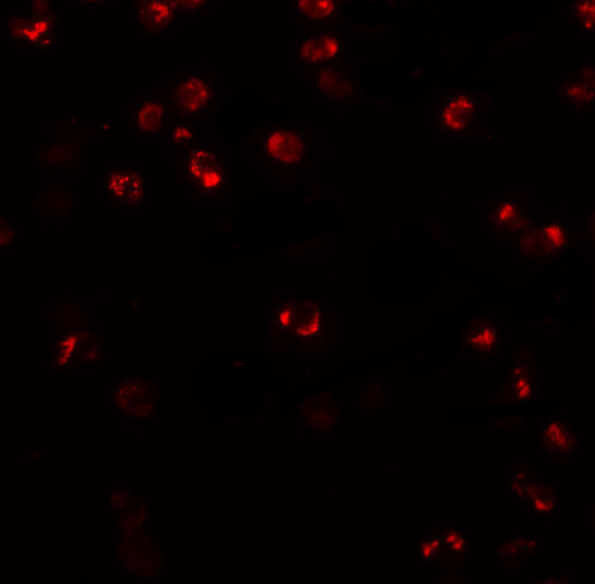 NLRP3 Antibody in Immunocytochemistry (ICC/IF)