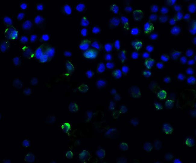 SQSTM1 Antibody in Immunocytochemistry (ICC/IF)