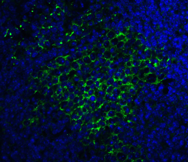 SQSTM1 Antibody in Immunohistochemistry (PFA fixed) (IHC (PFA))