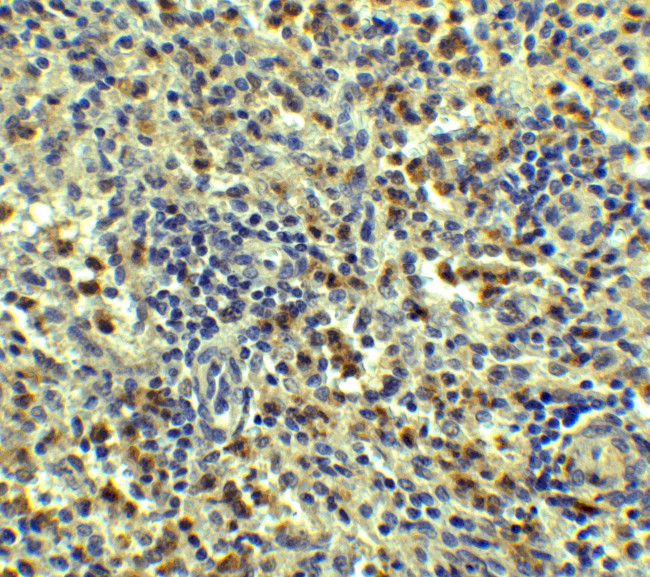 SQSTM1 Antibody in Immunohistochemistry (Paraffin) (IHC (P))