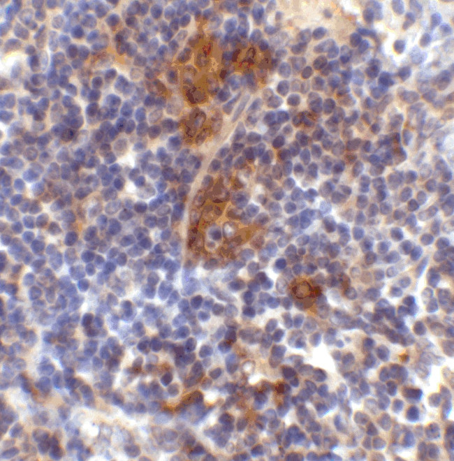 SQSTM1 Antibody in Immunohistochemistry (Paraffin) (IHC (P))