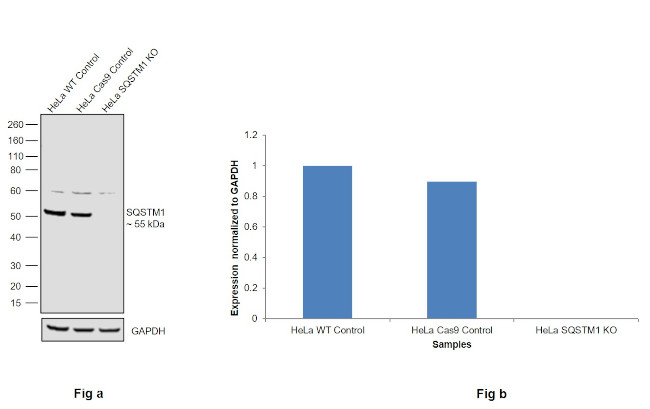 SQSTM1 Antibody