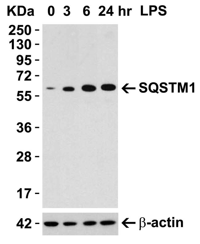 SQSTM1 Antibody in Western Blot (WB)