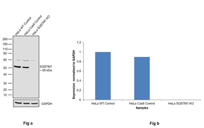 SQSTM1 Antibody in Western Blot (WB)