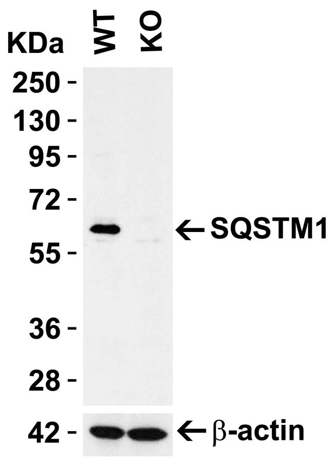 SQSTM1 Antibody in Western Blot (WB)