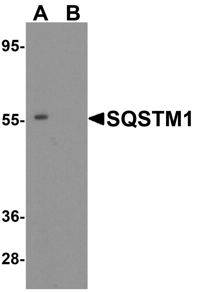 SQSTM1 Antibody in Western Blot (WB)