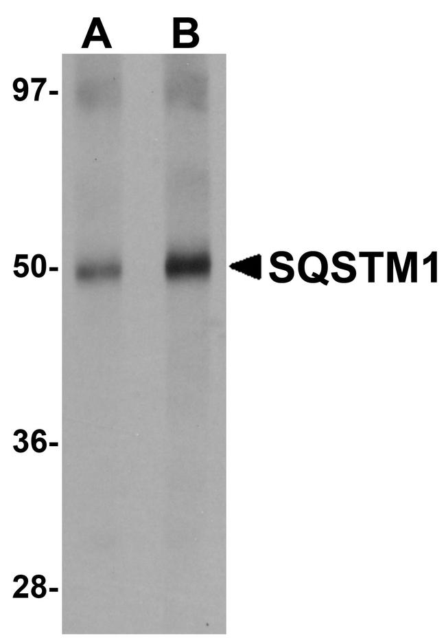 SQSTM1 Antibody in Western Blot (WB)