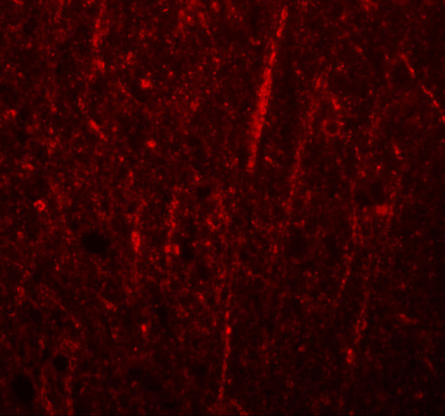 FRMPD4 Antibody in Immunohistochemistry (IHC)