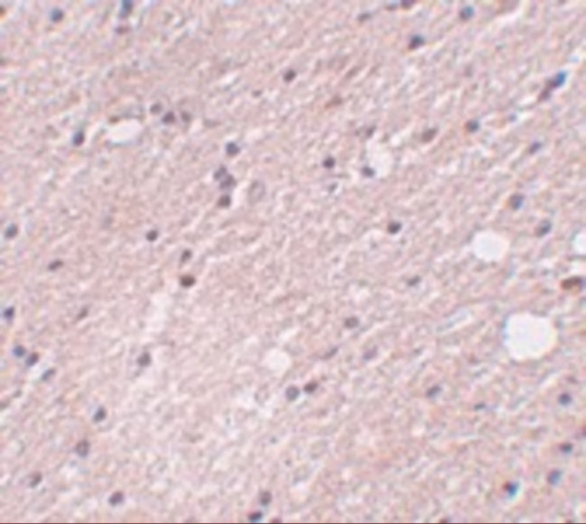 FRMPD4 Antibody in Immunohistochemistry (IHC)