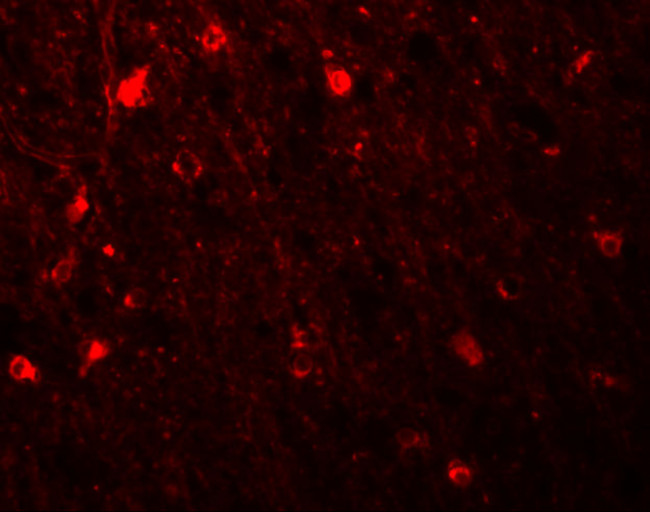 SIPA1L1 Antibody in Immunohistochemistry (IHC)