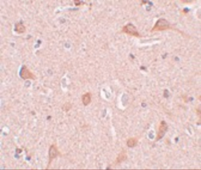 SIPA1L1 Antibody in Immunohistochemistry (IHC)