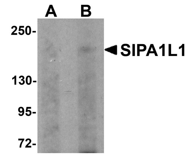 SIPA1L1 Antibody in Western Blot (WB)