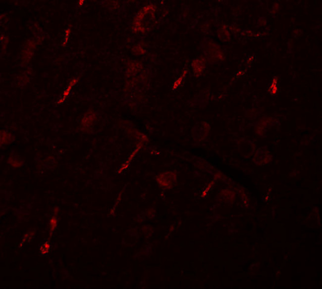 SIPA1L2 Antibody in Immunohistochemistry (IHC)