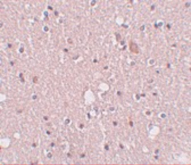 SIPA1L2 Antibody in Immunohistochemistry (IHC)