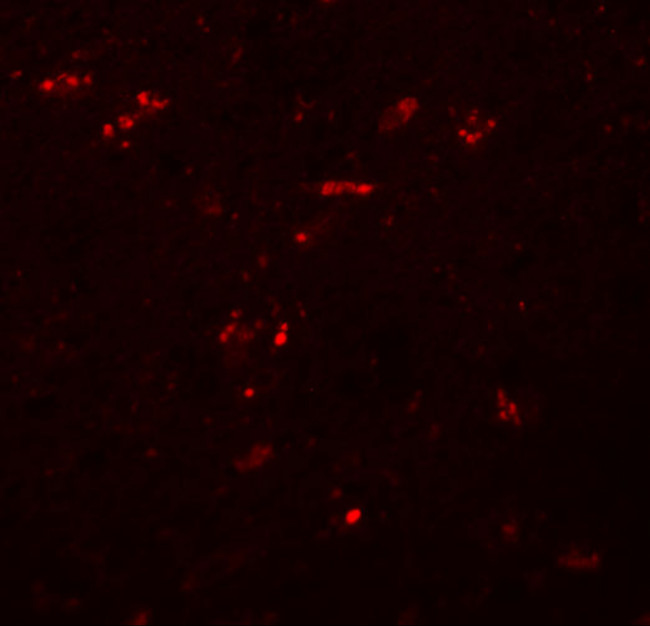 ZNF536 Antibody in Immunohistochemistry (IHC)