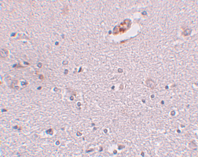 ZNF536 Antibody in Immunohistochemistry (IHC)