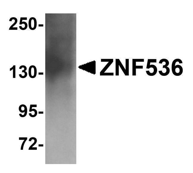 ZNF536 Antibody in Western Blot (WB)