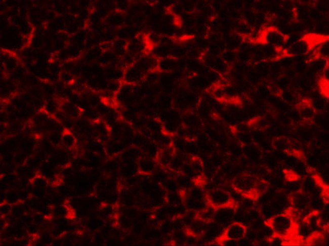 TMEM38B Antibody in Immunohistochemistry (IHC)