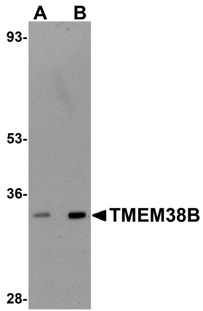 TMEM38B Antibody in Western Blot (WB)