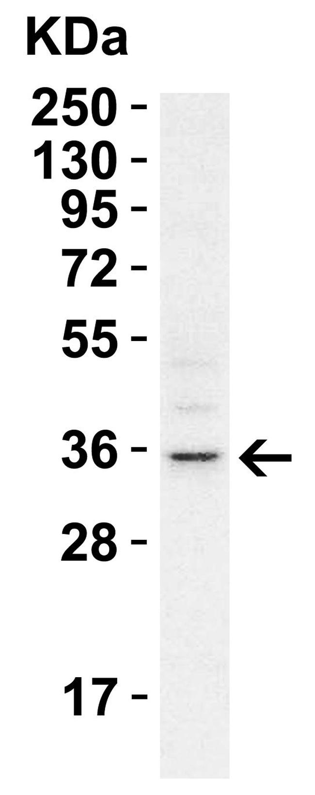 RHBDD1 Antibody in Western Blot (WB)