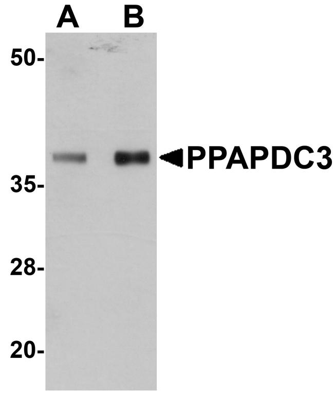 PPAPDC3 Antibody in Western Blot (WB)