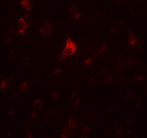 CALM Antibody in Immunohistochemistry (IHC)