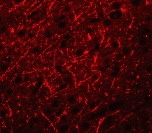 PRDM16 Antibody in Immunocytochemistry (ICC/IF)