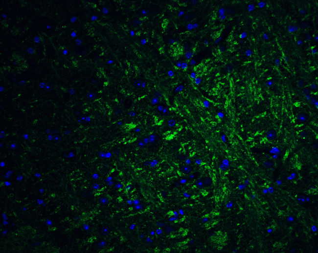 PRDM16 Antibody in Immunohistochemistry (IHC)