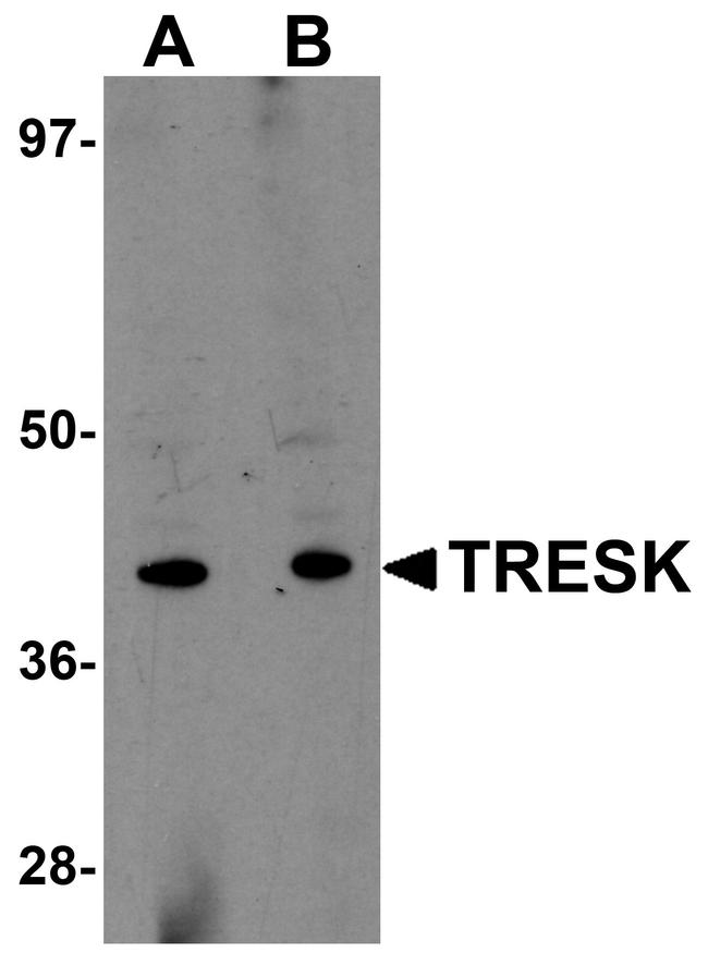 KCNK18 Antibody in Western Blot (WB)