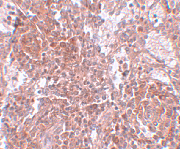 TSPAN9 Antibody in Immunohistochemistry (IHC)