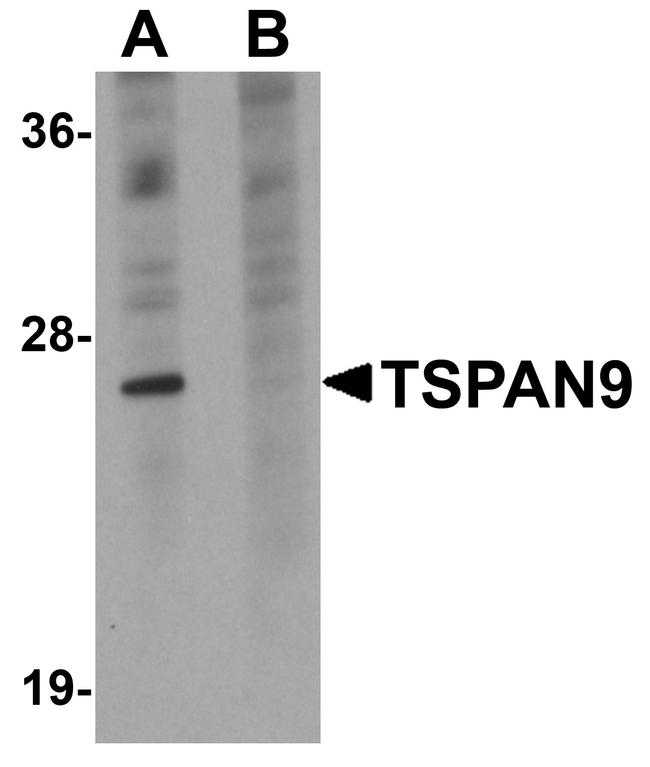 TSPAN9 Antibody in Western Blot (WB)