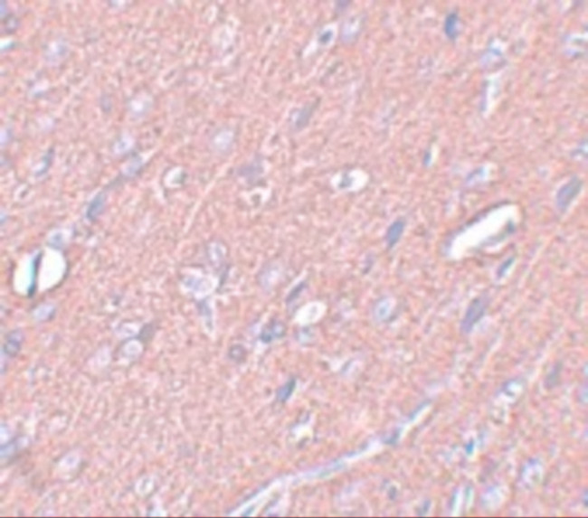 SYNGR3 Antibody in Immunohistochemistry (IHC)