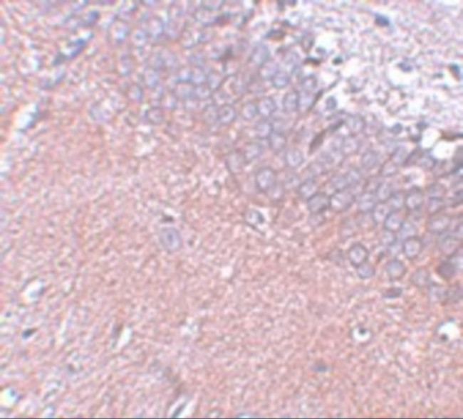 SYNGR4 Antibody in Immunohistochemistry (IHC)