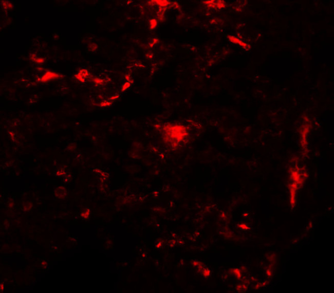 REEP2 Antibody in Immunohistochemistry (IHC)