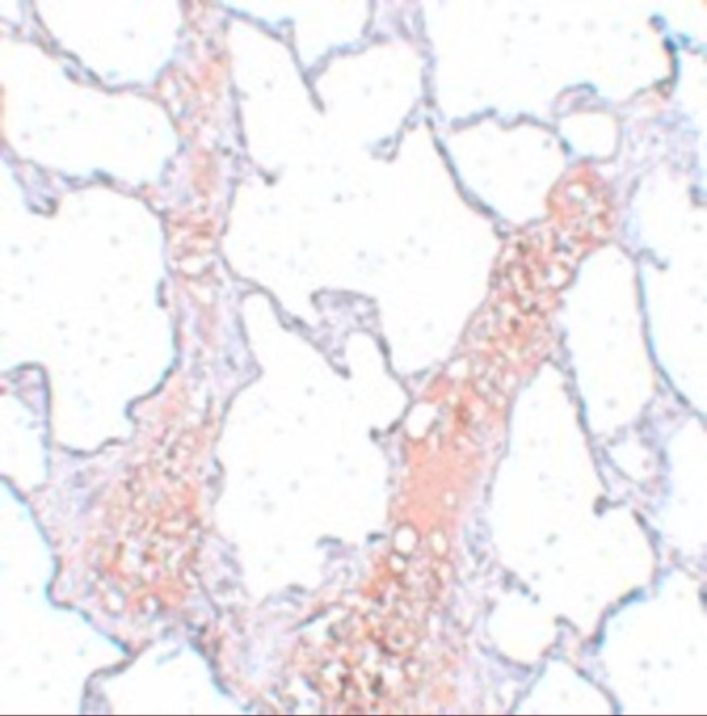 REEP2 Antibody in Immunohistochemistry (IHC)